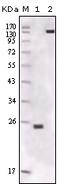 FER Tyrosine Kinase antibody, 32-151, ProSci, Western Blot image 