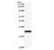 Metastasis-associated protein MTA3 antibody, LS-C342567, Lifespan Biosciences, Western Blot image 