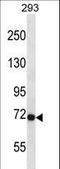 Fibroblast Growth Factor Receptor 3 antibody, LS-C164387, Lifespan Biosciences, Western Blot image 