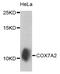 Glutamate-Cysteine Ligase Modifier Subunit antibody, PA5-76380, Invitrogen Antibodies, Western Blot image 