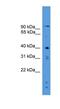 Serine Protease 23 antibody, NBP1-79488, Novus Biologicals, Western Blot image 