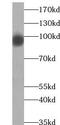 ATP Binding Cassette Subfamily F Member 1 antibody, FNab00040, FineTest, Western Blot image 