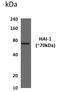 Serine Peptidase Inhibitor, Kunitz Type 1 antibody, GTX53177, GeneTex, Western Blot image 