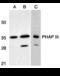 Acidic Nuclear Phosphoprotein 32 Family Member E antibody, A07456, Boster Biological Technology, Western Blot image 