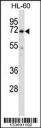 Tyrosine-protein kinase BTK antibody, MBS9207557, MyBioSource, Western Blot image 