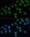 Carbamoyl-Phosphate Synthase 1 antibody, 23-386, ProSci, Immunofluorescence image 