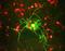 Neurofilament Medium antibody, A06821-1, Boster Biological Technology, Immunohistochemistry frozen image 