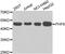 PHD Finger Protein 6 antibody, A7393, ABclonal Technology, Western Blot image 