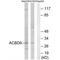Acyl-CoA Binding Domain Containing 6 antibody, A12915, Boster Biological Technology, Western Blot image 