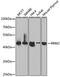 Ribonucleotide Reductase Regulatory Subunit M2 antibody, GTX33480, GeneTex, Western Blot image 