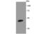 Nuclear Receptor Subfamily 1 Group H Member 3 antibody, A03331-1, Boster Biological Technology, Western Blot image 