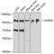 UV Radiation Resistance Associated antibody, GTX65976, GeneTex, Western Blot image 