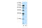 Decapping MRNA 1A antibody, 29-052, ProSci, Enzyme Linked Immunosorbent Assay image 