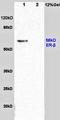 Tumor Protein P73 antibody, orb10615, Biorbyt, Western Blot image 