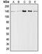 Collagen Type I Alpha 2 Chain antibody, MBS820457, MyBioSource, Western Blot image 