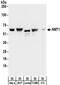 N-Myristoyltransferase 1 antibody, NBP2-32168, Novus Biologicals, Western Blot image 