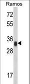 Major Histocompatibility Complex, Class II, DR Alpha antibody, LS-B11742, Lifespan Biosciences, Western Blot image 