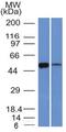 Aldehyde Dehydrogenase 1 Family Member A1 antibody, GTX34400, GeneTex, Western Blot image 