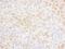 Serine/Threonine Kinase 17a antibody, NBP1-42693, Novus Biologicals, Immunohistochemistry frozen image 