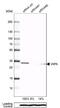 VAMP Associated Protein A antibody, NBP1-83132, Novus Biologicals, Western Blot image 