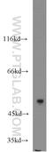 MAPK Activated Protein Kinase 5 antibody, 14339-1-AP, Proteintech Group, Western Blot image 