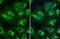 Translocase Of Outer Mitochondrial Membrane 20 antibody, GTX133756, GeneTex, Immunocytochemistry image 