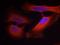 Keratin 8 antibody, GTX50320, GeneTex, Immunocytochemistry image 