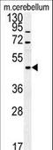 FUS RNA Binding Protein antibody, LS-C166279, Lifespan Biosciences, Western Blot image 
