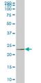 NOP16 Nucleolar Protein antibody, H00051491-M01, Novus Biologicals, Western Blot image 