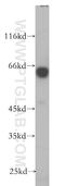 Prune Exopolyphosphatase 1 antibody, 18537-1-AP, Proteintech Group, Western Blot image 