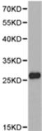 Proteasome Subunit Alpha 6 antibody, TA322959, Origene, Western Blot image 