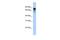 Dihydropyrimidinase Like 3 antibody, PA5-43752, Invitrogen Antibodies, Western Blot image 