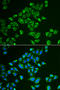 Tachykinin 3 antibody, STJ28234, St John