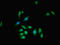 Zinc Finger MYND-Type Containing 11 antibody, orb53423, Biorbyt, Immunofluorescence image 