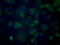 Cytochrome P450 Family 1 Subfamily A Member 2 antibody, GTX84638, GeneTex, Immunofluorescence image 