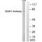 SUMO Specific Peptidase 1 antibody, A02156, Boster Biological Technology, Western Blot image 