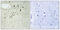 Empty Spiracles Homeobox 2 antibody, LS-C198918, Lifespan Biosciences, Immunohistochemistry paraffin image 