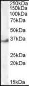 LIM And SH3 Protein 1 antibody, orb89930, Biorbyt, Western Blot image 