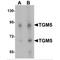 Transglutaminase 5 antibody, MBS150679, MyBioSource, Western Blot image 