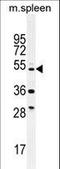 Tetratricopeptide Repeat Domain 23 Like antibody, LS-C160294, Lifespan Biosciences, Western Blot image 