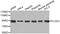 Procollagen-Lysine,2-Oxoglutarate 5-Dioxygenase 3 antibody, MBS126263, MyBioSource, Western Blot image 