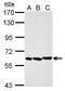 Protein Inhibitor Of Activated STAT 2 antibody, GTX115180, GeneTex, Western Blot image 