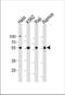 p65 antibody, TA324680, Origene, Western Blot image 