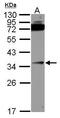 Tumor necrosis factor receptor superfamily member 6B antibody, PA5-34825, Invitrogen Antibodies, Western Blot image 