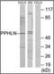 Periphilin 1 antibody, orb96522, Biorbyt, Western Blot image 