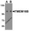 Anoctamin 2 antibody, 5421, ProSci, Western Blot image 