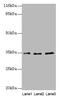 Alpha-2-Glycoprotein 1, Zinc-Binding antibody, CSB-PA11039A0Rb, Cusabio, Western Blot image 