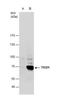 Tigger Transposable Element Derived 1 antibody, NBP2-20640, Novus Biologicals, Western Blot image 