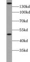 Zinc Finger RANBP2-Type Containing 3 antibody, FNab09756, FineTest, Western Blot image 