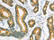 SUFU Negative Regulator Of Hedgehog Signaling antibody, CSB-PA954231, Cusabio, Immunohistochemistry paraffin image 